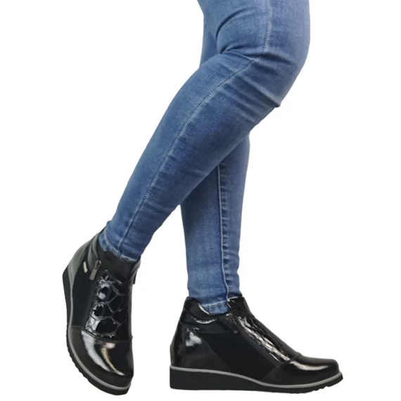 L'art / B bokacsizma